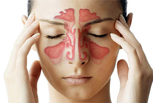 Гайморит у взрослых