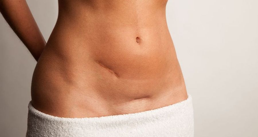 Важно правильно питаться, чтобы избавиться от обвисшего живота