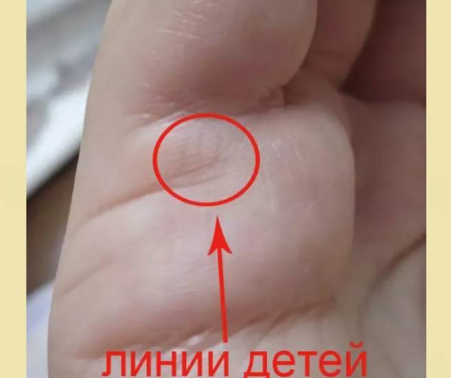 Полоски, указывающие на количество будущих малышей