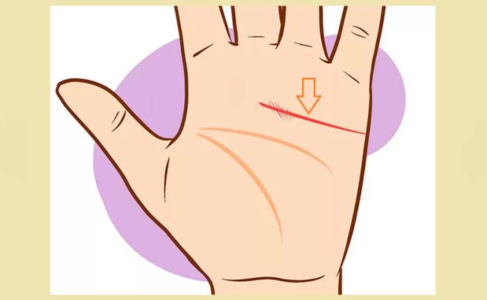 Укороченная полоса сердца на ладони