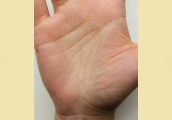 Двойная полоска головы