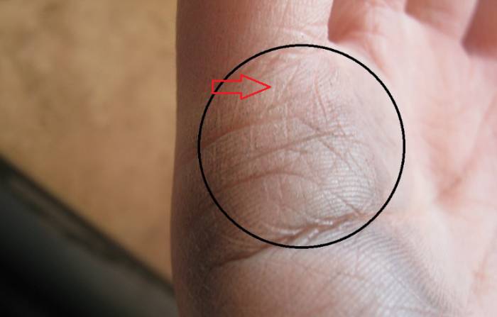 Пример линии деток