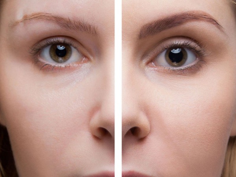 Татуаж бровей позволит выделить и усовершенствовать даже самые убогие брови