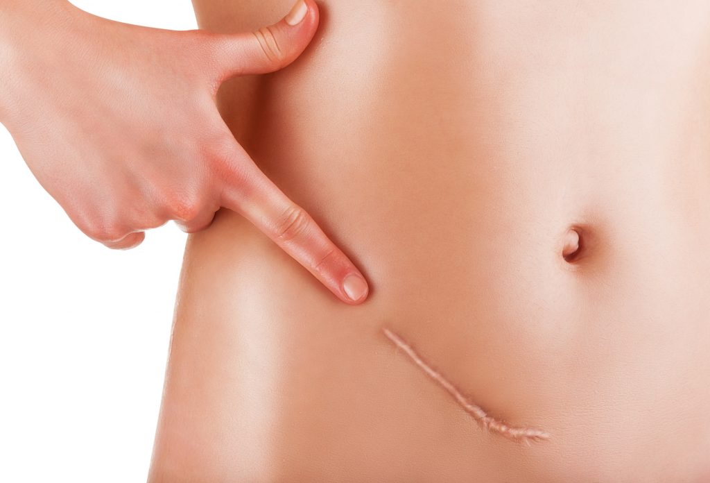 После операции