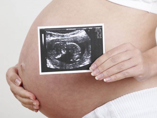 images_cms-image-000002374