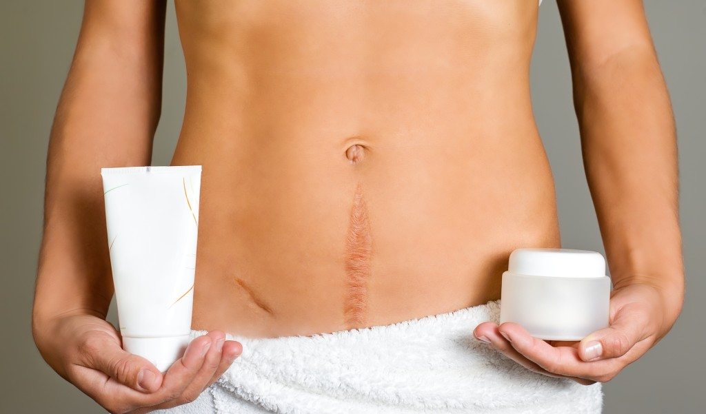 Виды хирургического лечения шрамов